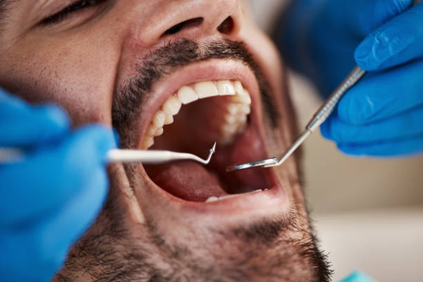 Best Full Mouth Reconstruction  in Algona, WA